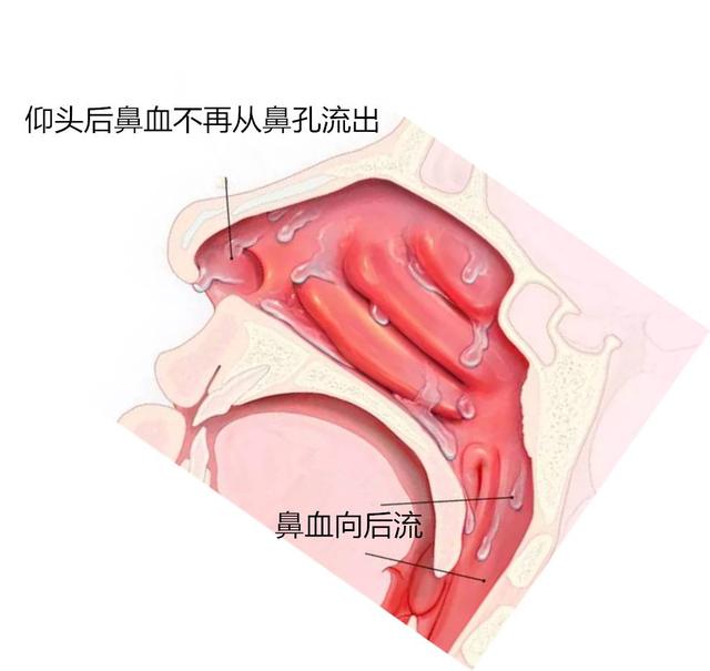 小面积烧伤的家庭急救指南